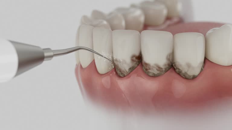 Reliable Root Canal Treatment contractor in Caldwell Parish County, LA by Dentist Open Now